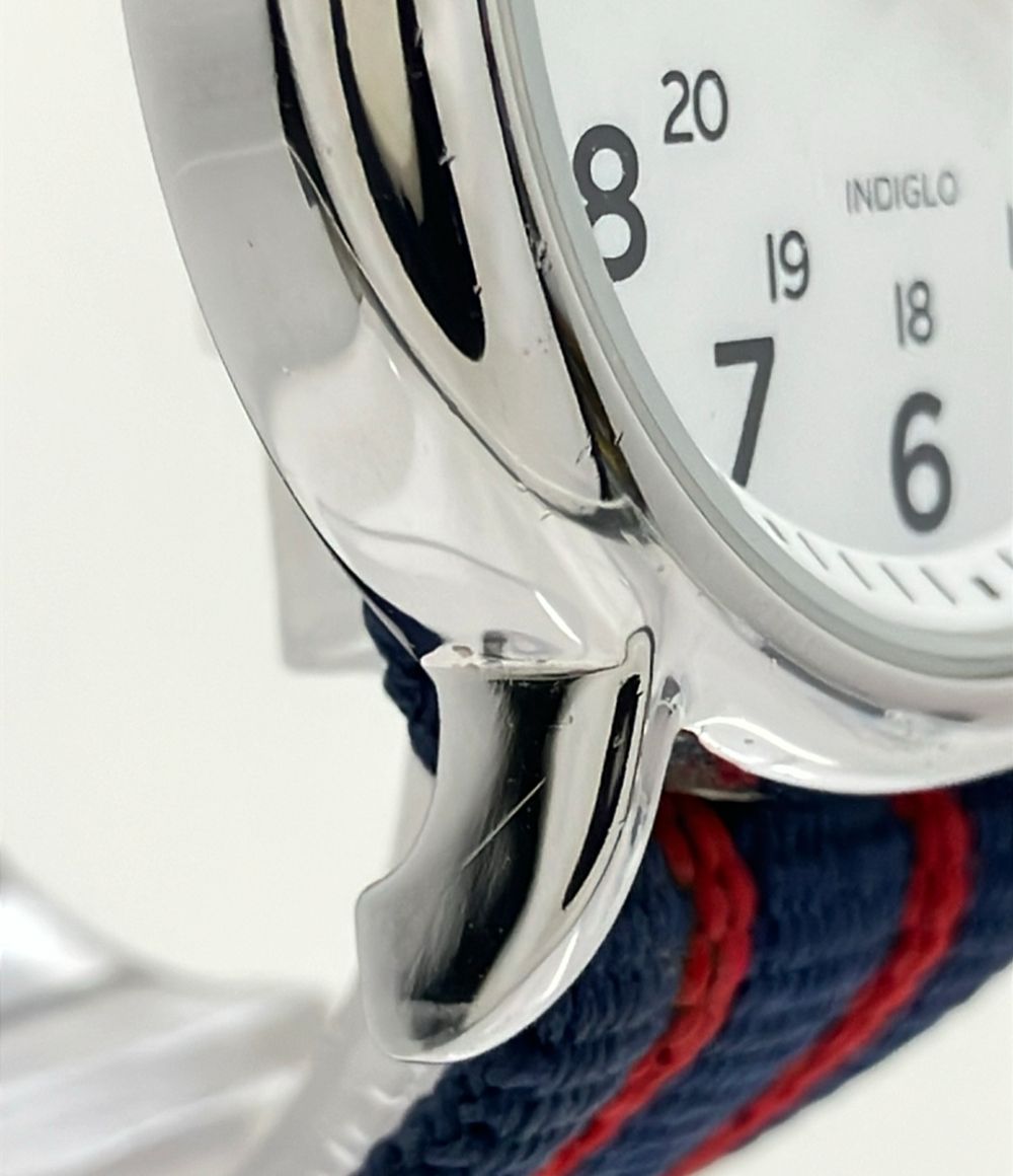 timex watch condition details